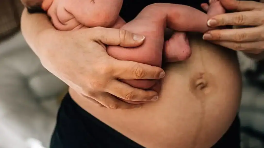 Why Is My Stomach Still Big After Pregnancy Dumbarton?